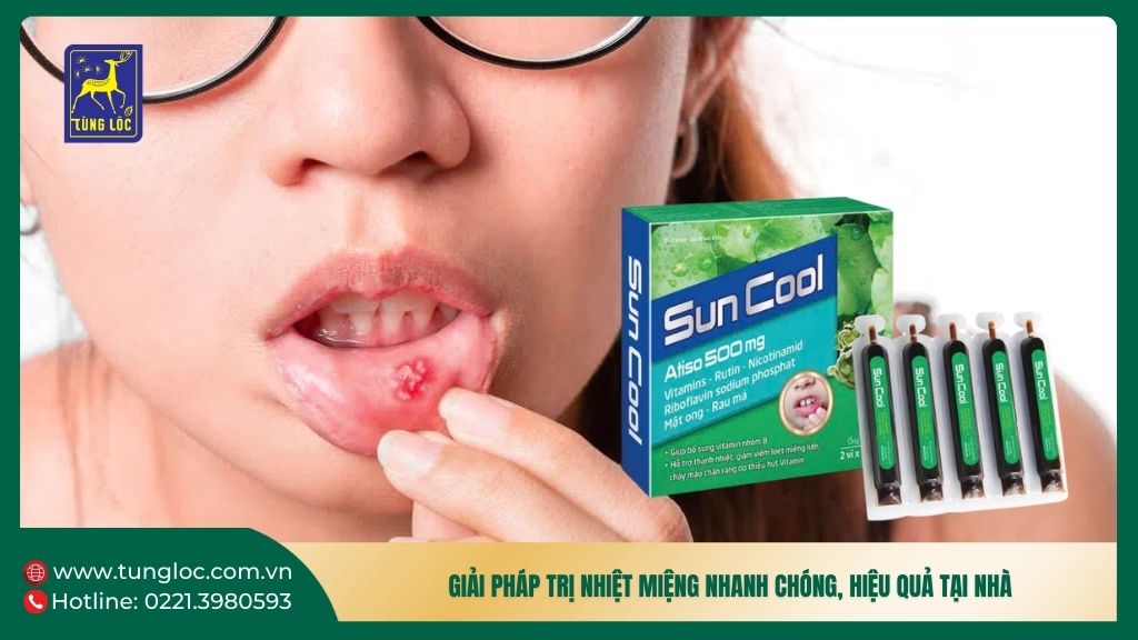 Giải pháp trị nhiệt miệng